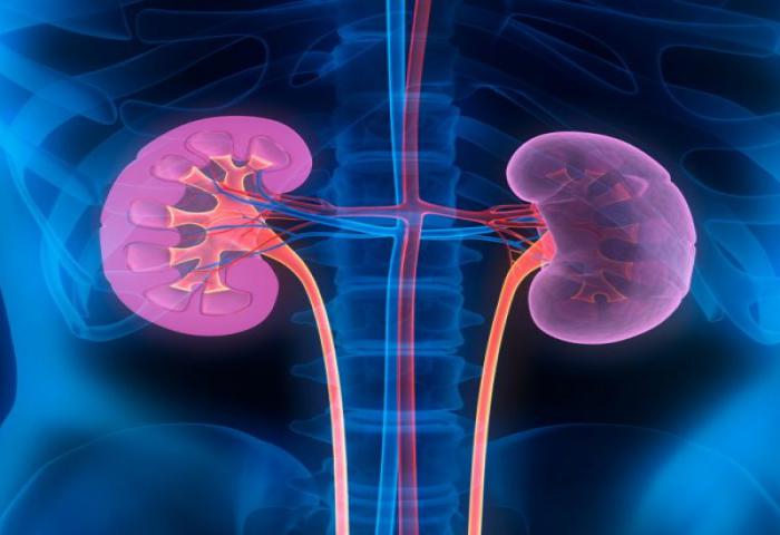 Transplantasi Terapi Ideal Bagi Penderita Gagal Ginjal